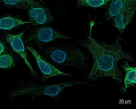 Sk818 2 Human Derived Cells Fluorescence Microscopy Flickr