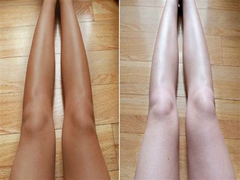 Zeichner says that while anyone can get them, they tend to be more common in patients with darker skin tones. How to Lighten Body Skin Color in 2 days -Legs, Hands ...