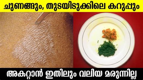 ചുണങ്ങും തുടയിടുക്കിലെ കറുപ്പും മാറാൻ ഇതിലും വലിയ മരുന്നില്ല Get Rid