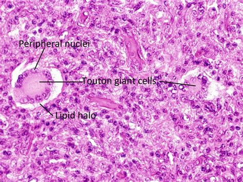 Moran Core Cellular Histopathology