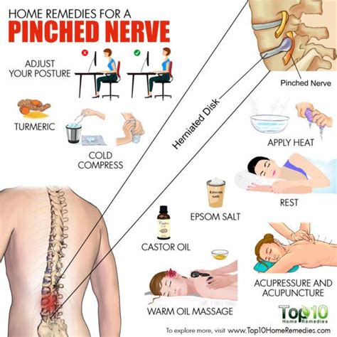 Home Remedies For A Pinched Nerve Blog Health Wau