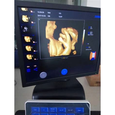 4d Ultrasound Scanner Professional Hospital Equipment Manufacture