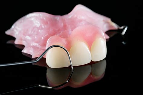 4 Types Of Partial Dentures Available With Online Dental Labs Dental