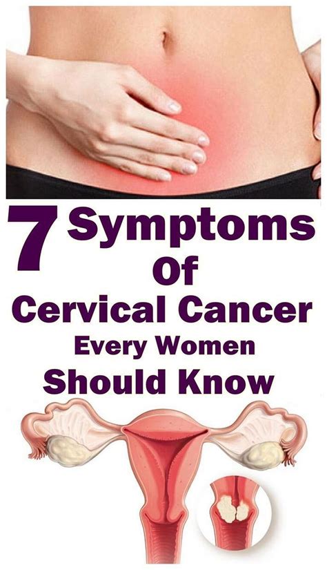7 Warnings Of Indications Of Cervical Malignancy That Every Woman Must