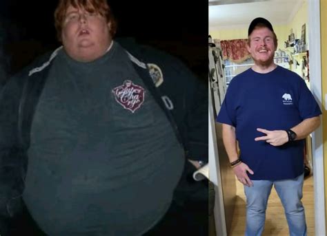 Casey King Weight Loss Surgery Diet And Before And After Photographs
