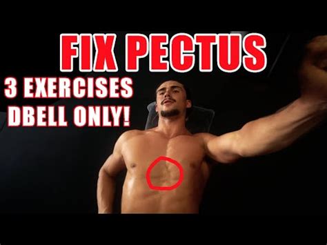 Exercises To Fix Pectus Excavatum DUMBBELL ONLY YouTube