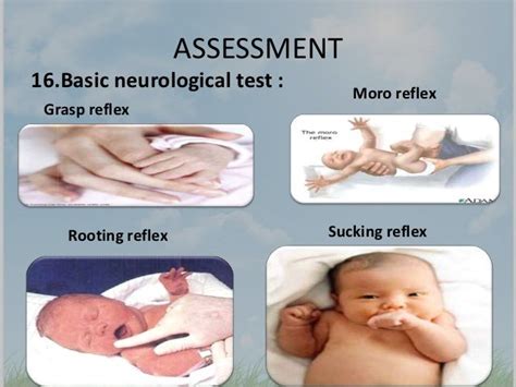 Assessment Newborn