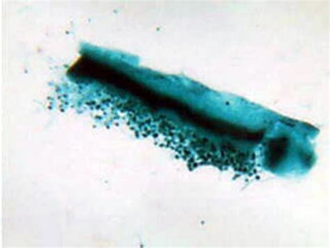 Aspergillus Fungus Prepared Microscope Slide