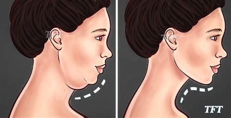 Best Exercises To Get Rid Of Double Chin And Neck Fat Video