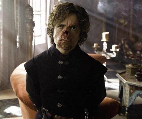 Tyrion Lannister If The Show Made Him Look Like He Did In The Books Rgameofthrones