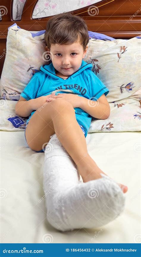 A Little Boy With A Broken Leg Is Lying On The Bed Stock Photo Image