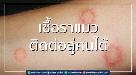 เชื้อราแมว ติดต่อสู่คนได้