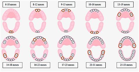 Odontopediatria Clínica Dental Salcodent Getafe