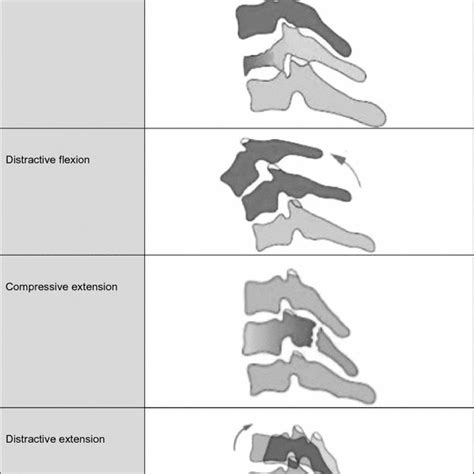 The Aospine Subaxial Cervical Spine Injury Classification Main