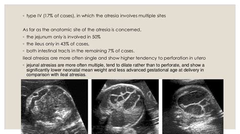 Fetal Anomaly Scan Pt2