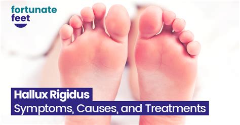 Hallux Rigidus Symptoms Causes And Treatments Fortunate Feet