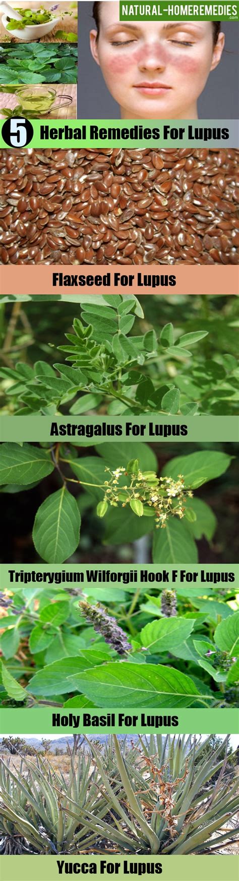 Top 5 Herbal Remedies For Lupus Natural Home Remedies