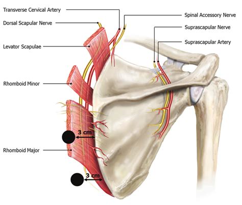 Dissection Showing The Dorsal Scapular Nerve The Dorsal Scapular Nerve