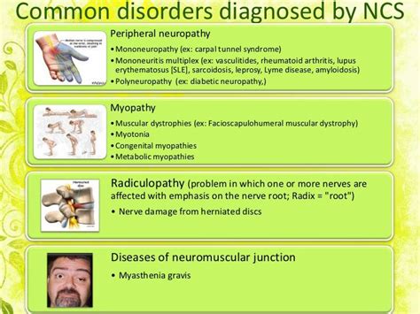 Common Disorders Diagnosed By Ncs Peripheral Neuropathy