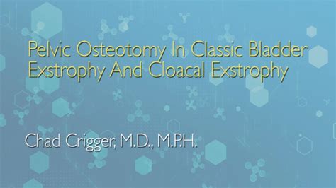 Pelvic Osteotomy In Classic Bladder Exstrophy And Cloacal Exstrophy Johns Hopkins Medicine