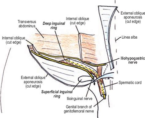This video explains all the details of the anatomy of inguinal canal, inguinal hernias and anterior abdominal wall.below is the list of all the lecture. The Diagnostic Anatomy of the Inguinal Complex of Nerves ...