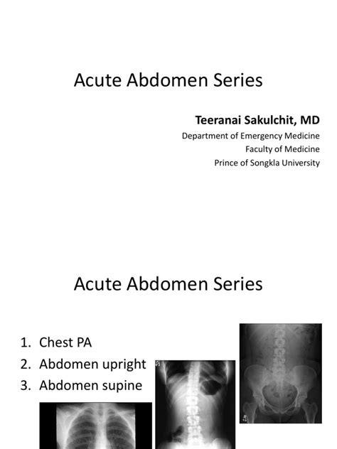 Acute Abdomen Seriesss Pdf Abdomen Gastroenterology