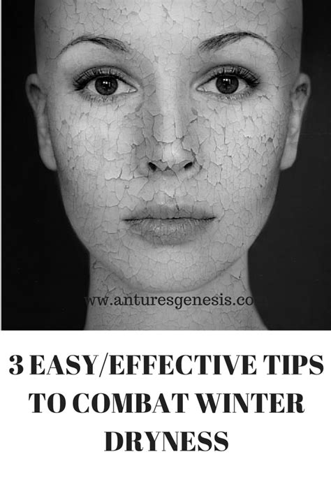 3 Easy Steps To Help With Winter Skin Dryness Winter Skin Skin