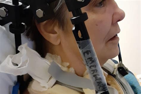 Fundraiser By Amy Edwards Need Help After Broken Neck And Being Paralyzed