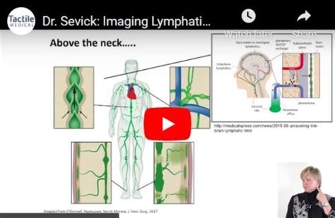 Imaging Lymphatic Function In Head And Neck Cancer Patients Tactile