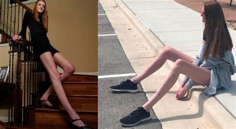 Joven rompe el récord Guinness con las piernas más largas del mundo video El Popular