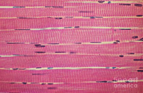 Skeletal Muscle Tissue Diagram Diagram Quizlet