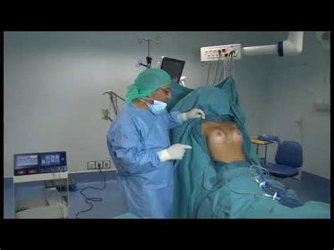 Pose de prothèses mammaires par voie péri aréolaire Dr Masson YouTube