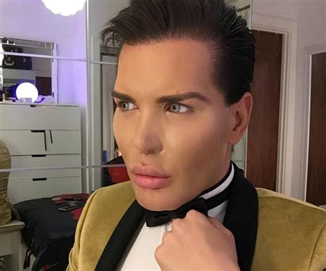 Real Life Ken Doll Rushed To Hospital After Face Begins To Collapse