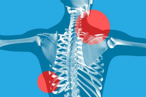 Stomach Pain Mapping