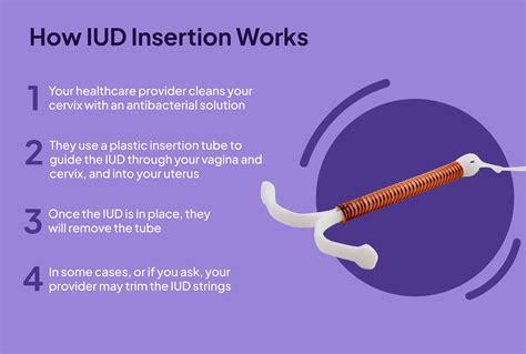 Iud Insertion How It Works And What To Expect