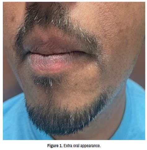 Clinical Case Reports Oral Appearance