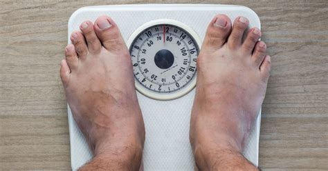 Extreme weight loss brings extreme problems