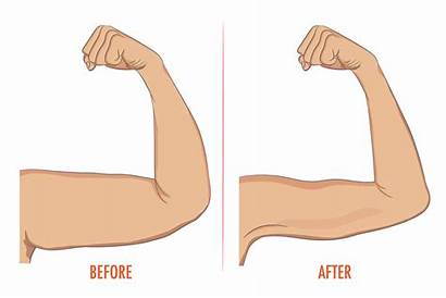 Arm Fat Exercises Underarm Arms Brazos Exercise
