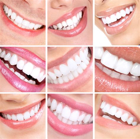 What Are Some Great Benefits Of Tooth Coloured Fillings Telegraph