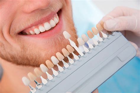 Tendencias en tratamientos de estética dental para El blog de Vitaldent Hábitos