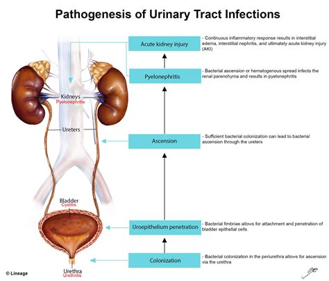 Pathophysiology Of Urinary Tract Infection Sharedoc
