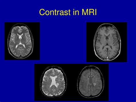 Ppt Contrast In Mri Powerpoint Presentation Free Download Id6298927