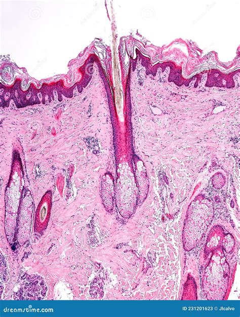 Human Skin Pilosebaceous Unit Stock Image Image Of Epithelium