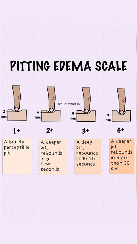 Pitting Edema Scale For Nursing Students And Nurses Nursing School