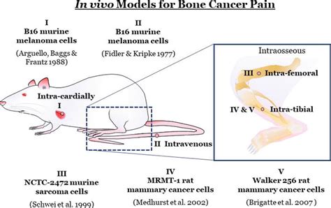 Bone Cancer Pain Mechanism And Treatment Intechopen