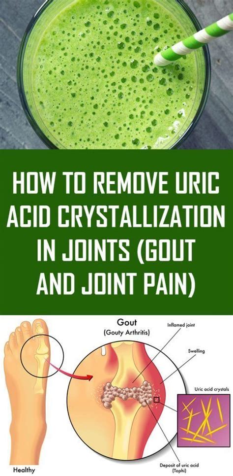 How To Remove Uric Acid Crystallization In Joints Gout And Joint Pain