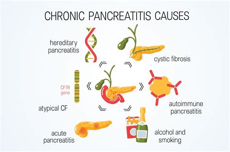 Chronic pancreatitis is usually a complication of recurrent episodes of acute pancreatitis. Diverse Risk Factors Associated With Calcifications in ...