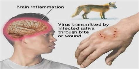 Rabies Diagnosis Treatment And Prevention Zoefact