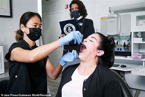 Woman Whose Mouth Opens Inches Becomes Guinness World Record Holder Daily Mail Online
