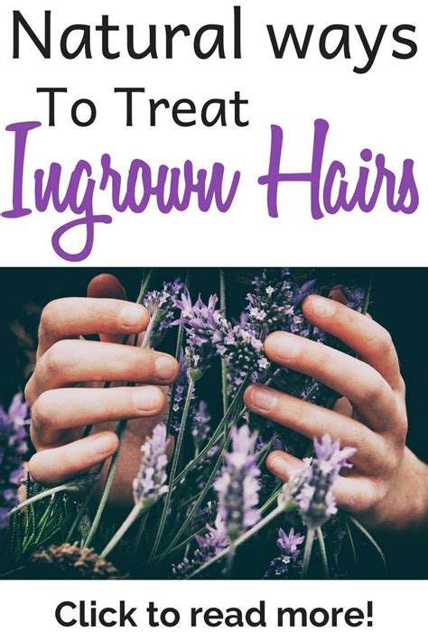 The way you treat an ingrown hair you it is the same with ingrown hairs. 24 home remedies to treat and prevent ingrown hairs ...